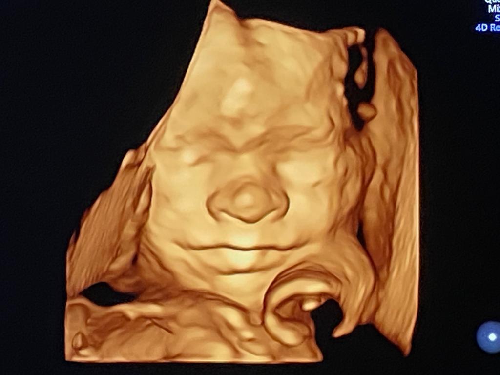 UNIDAD MATERNO FETAL