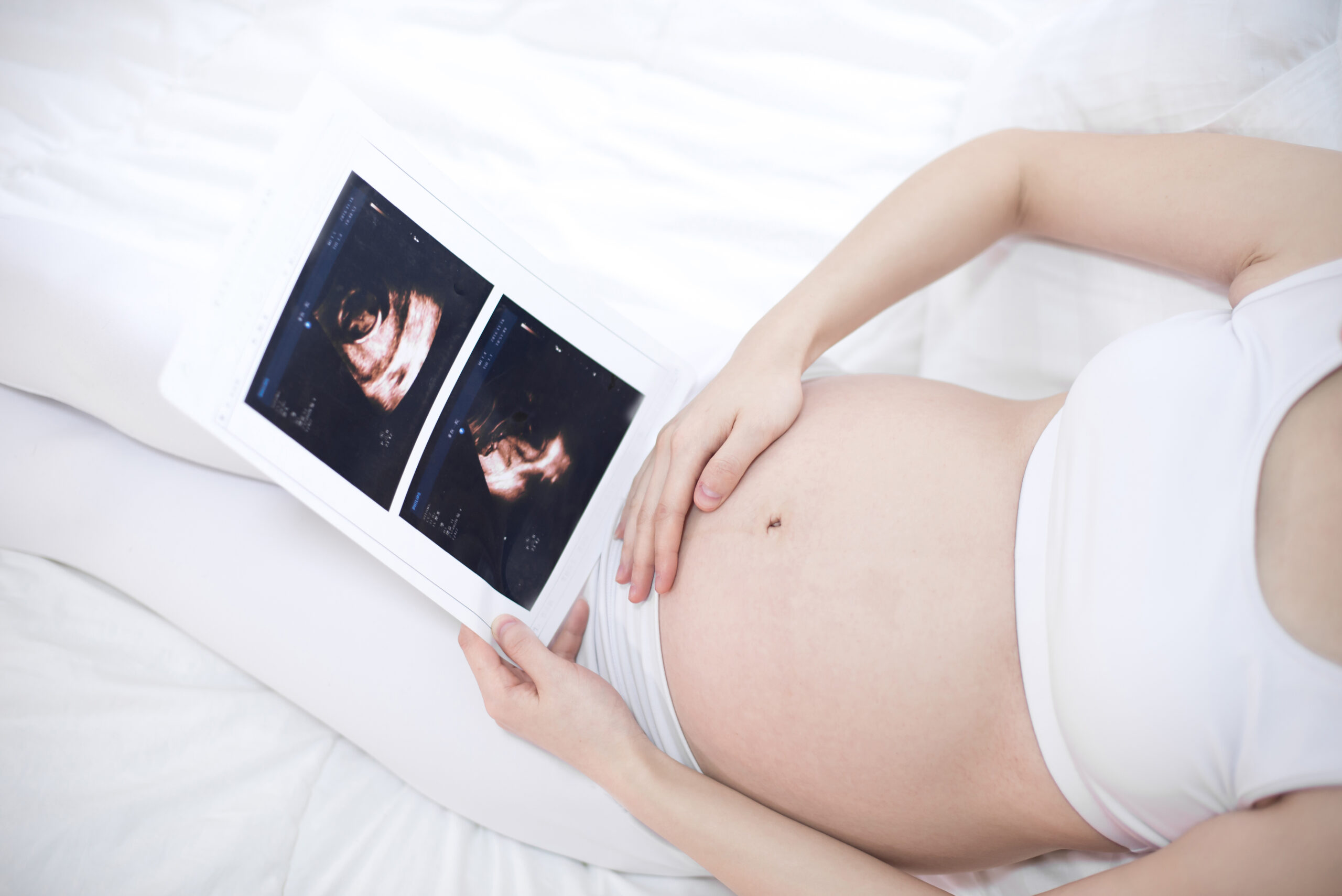 UNIDAD MATERNO FETAL